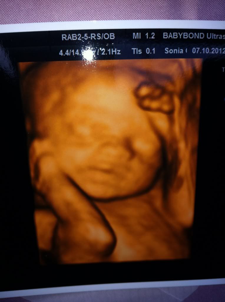 scan 4d baby