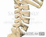 flexion of spine